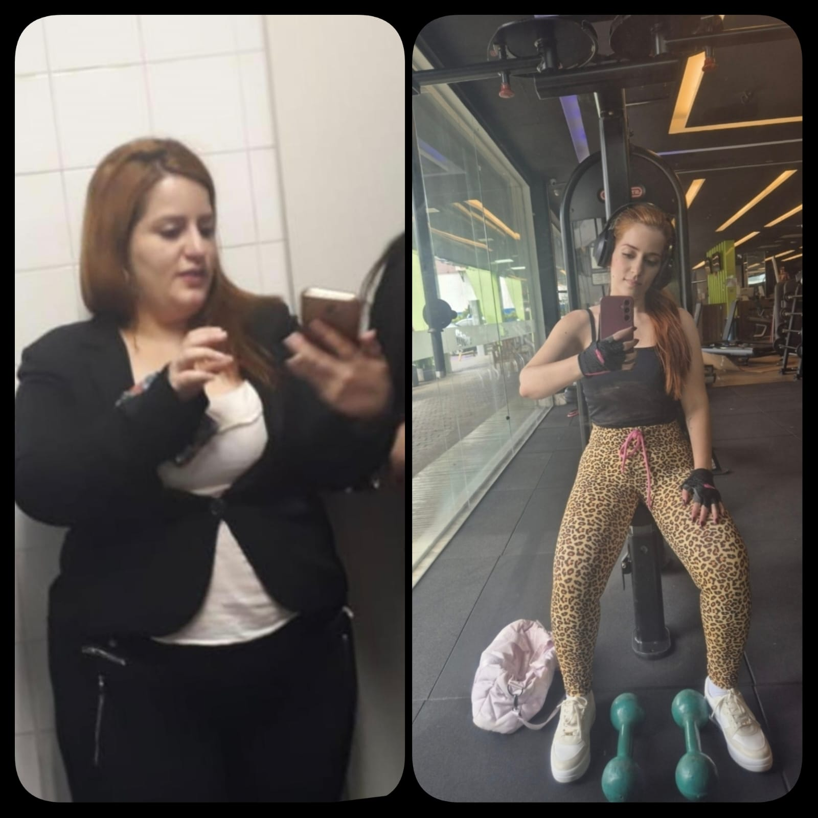 Antes e depois de paciente 4