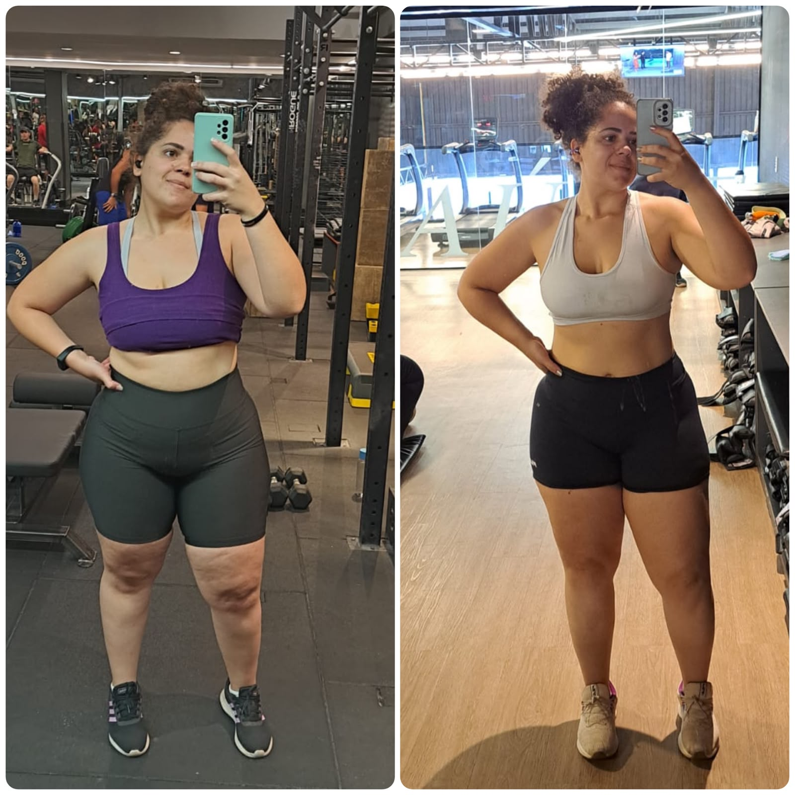 Antes e depois de paciente 6