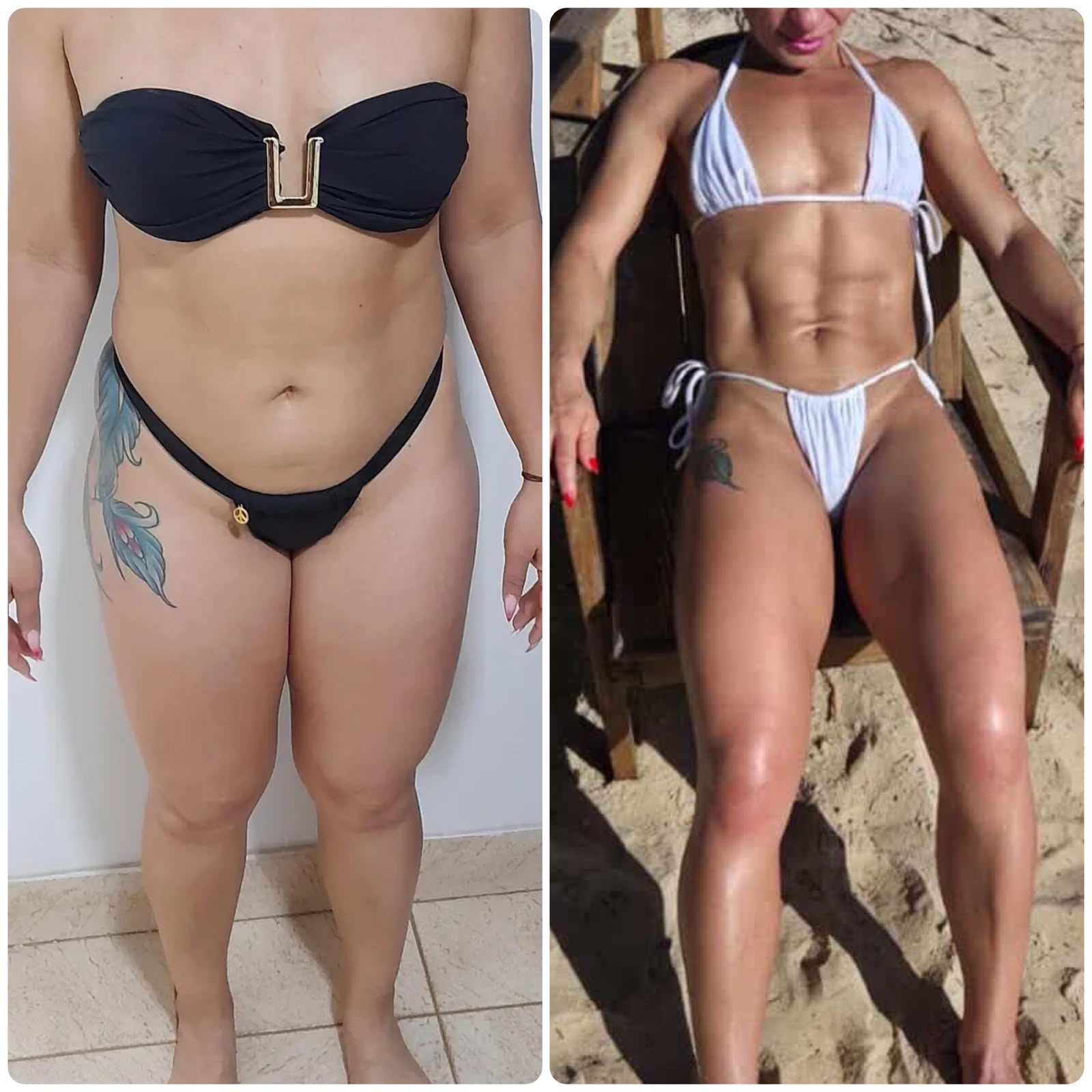 Antes e depois de paciente 3