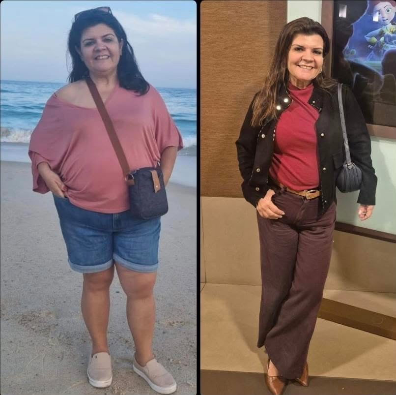 Antes e depois de paciente 7