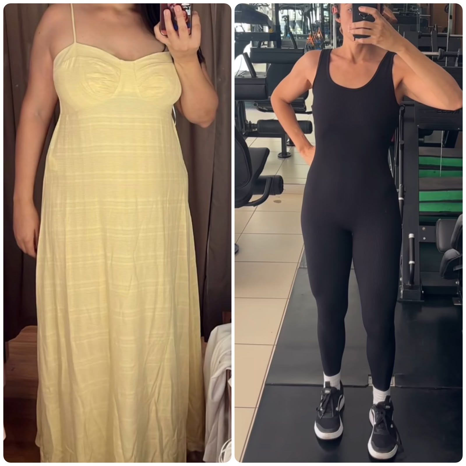Antes e depois de paciente 1