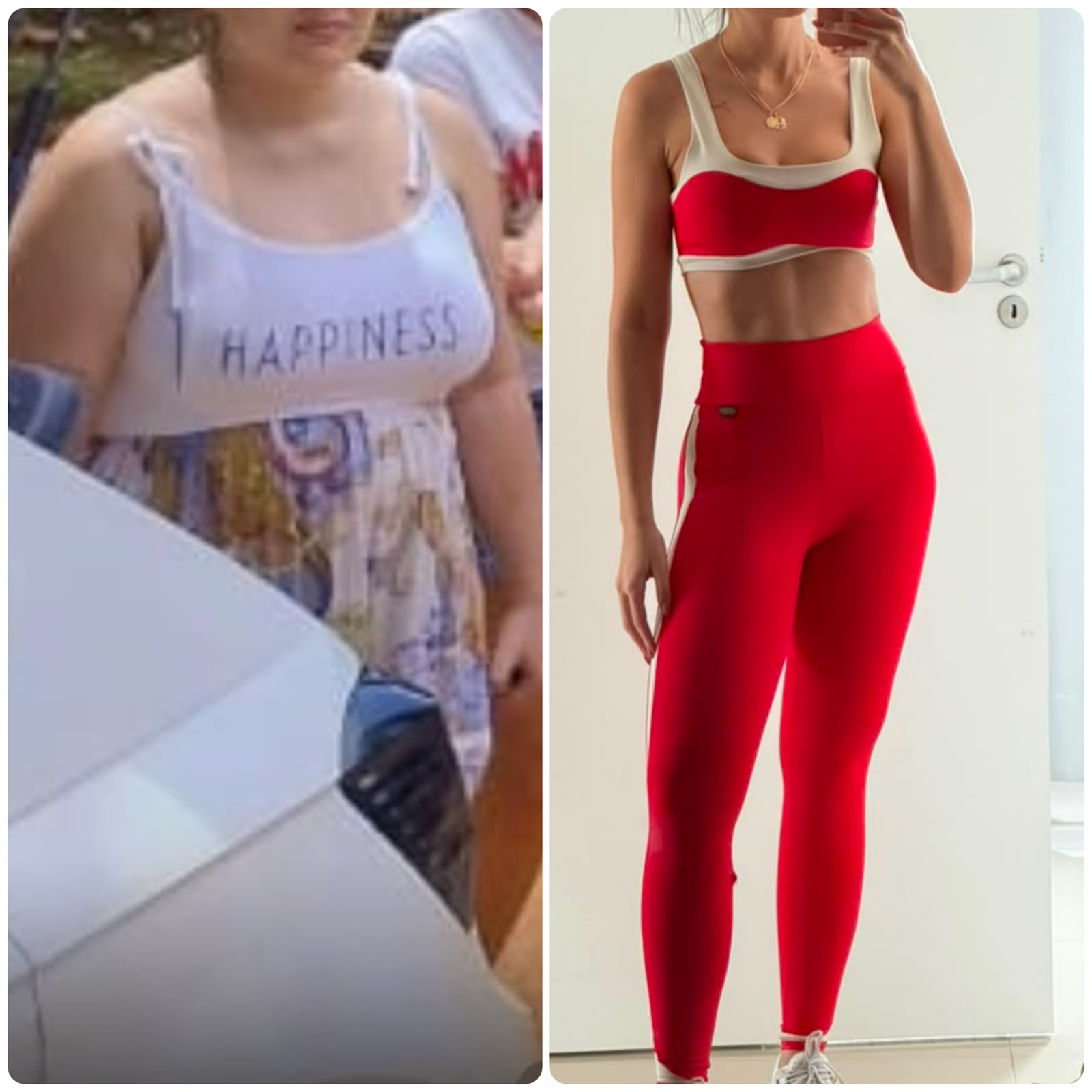 Antes e depois de paciente 2